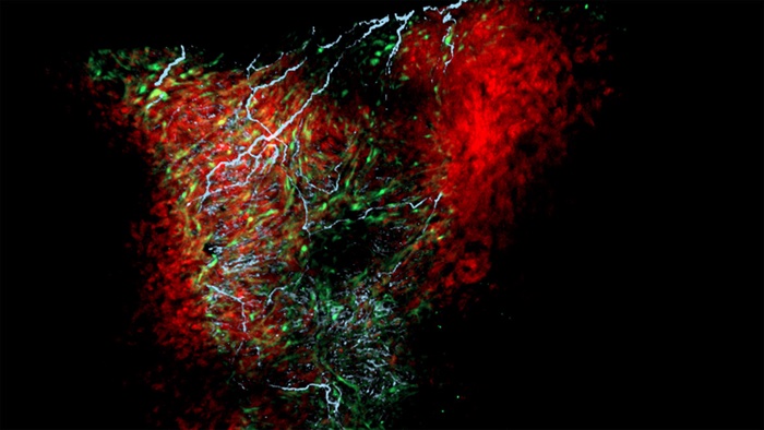 Glial Cell in Heart Found to Be a Regulator of Heart Rate