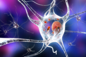Neurons in Parkinson's disease