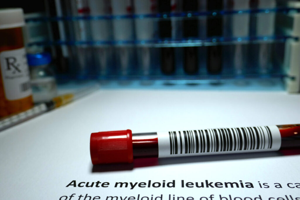 Acute myeloid leukemia