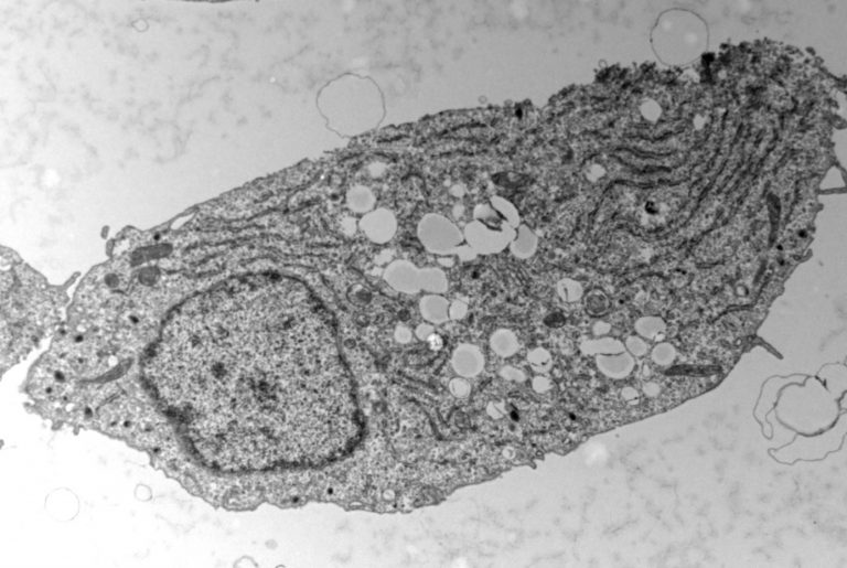 Fat Cycle Helps Pancreatic Beta Cells Adapt to Excess Sugar