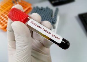Scientist hold blood sample for Glutamate dehydrogenase (GDH) test with lab background