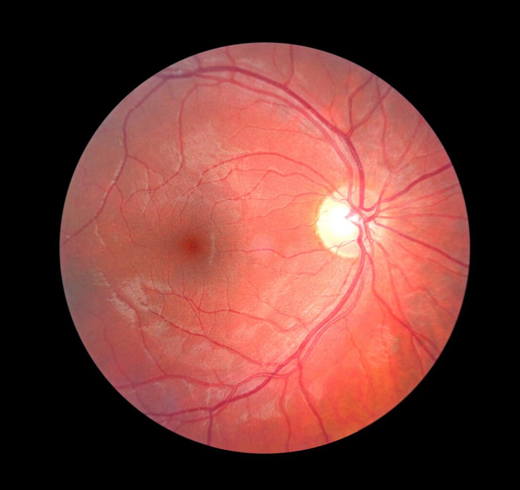 Inner-view of a retina with light shining through