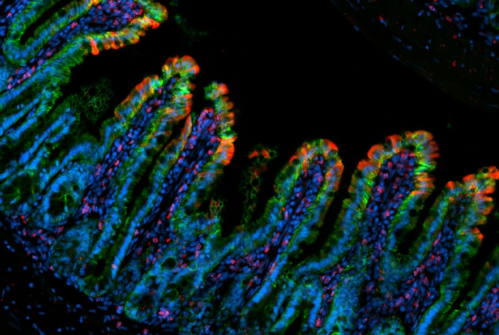 Growth Factor Made by Immune Cells Protects Gut From Inflammation