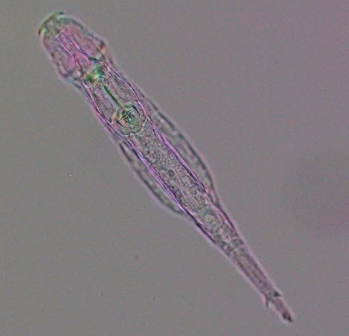 New Epigenetic Mark Found in Rotifer Was Captured from Bacteria 60 mya