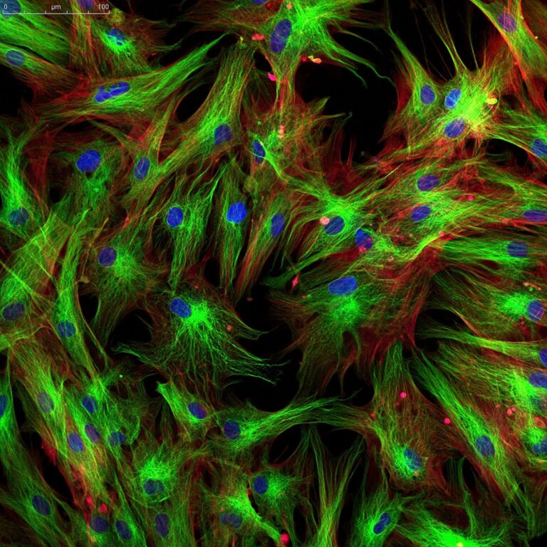 Finding Therapies in Fibroblasts