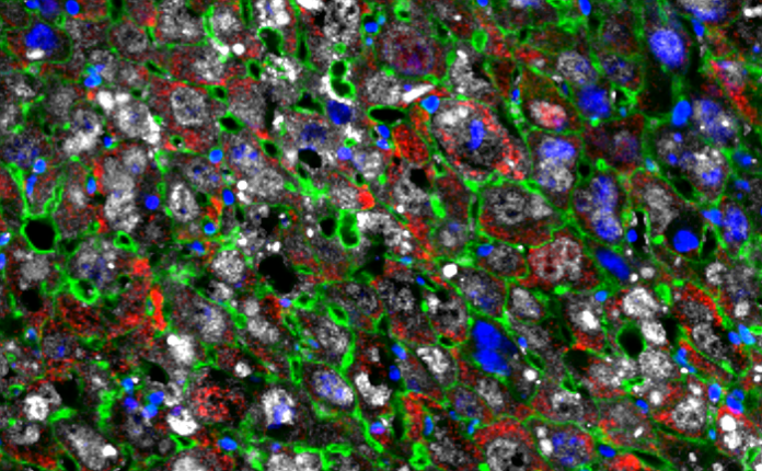 Cellular Reprogramming Improves Liver Regeneration in Mice