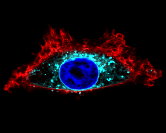 Novel “SwissKASH” Tool Visualizes Palmitoylation in Living Cells