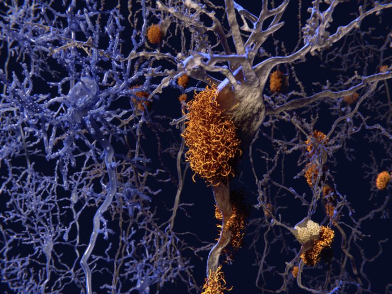 Novel Molecule Targets Inflammation in Alzheimer’s Models