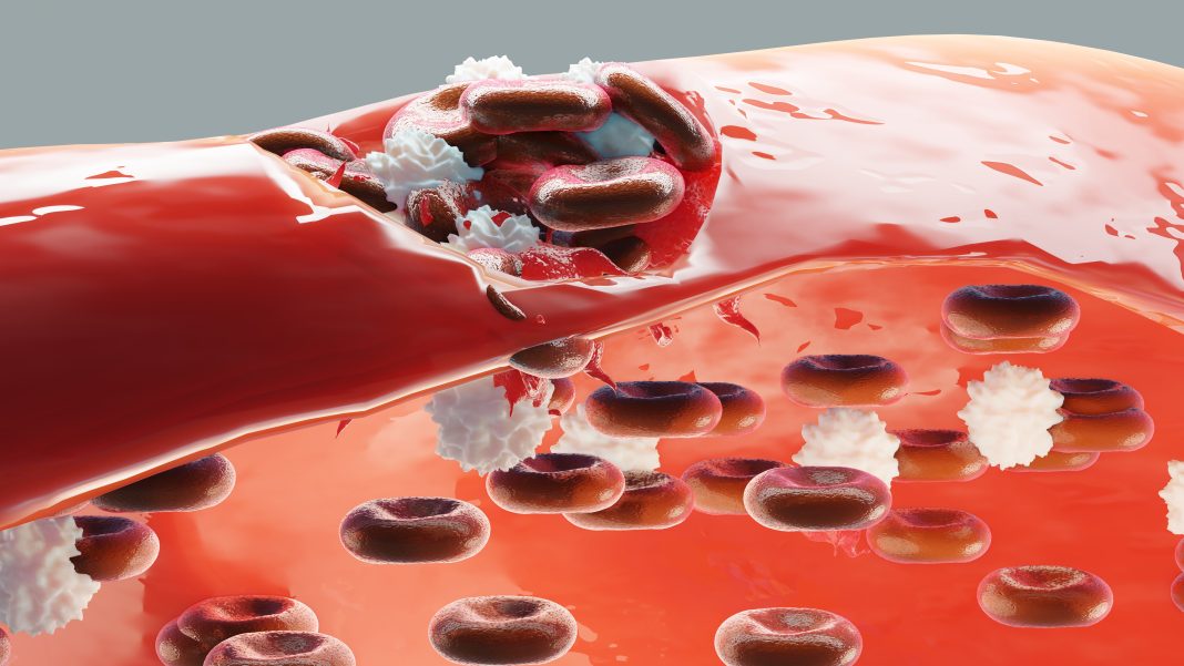 Hemostasis. Red blood cells and platelets in the blood vessel. Basic steps of wound healing process. 3d illustration