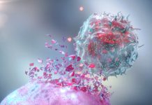 Autoimmune Diseases May Be Driven by Killer T Cells That Go Rogue