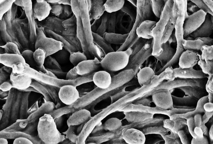 Therapeutic Target against Common Fungus Uncovered by Cryo-Electron Microscopy