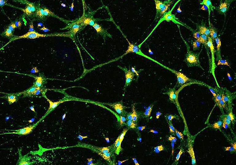 Why We Need an Alzheimer’s Moonshot in 2022