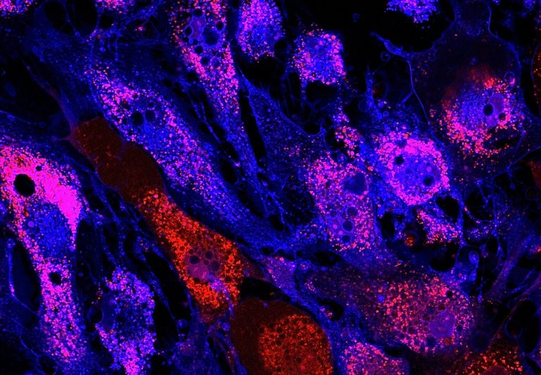 Stem Cell-Made Immune Model Helps Protect Immunocompromised against Infection