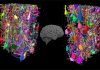 3D EM Uncovers Differences in Neural Circuits of Mice, Monkeys, and Humans