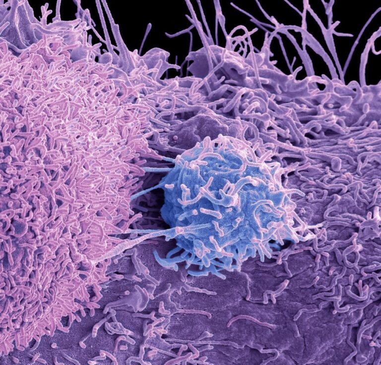 Using Iron to Help Kill Resistant Prostate Cancer Cells