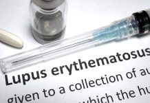 Antiviral Protein Combinations Are Responsible for Lupus Symptoms
