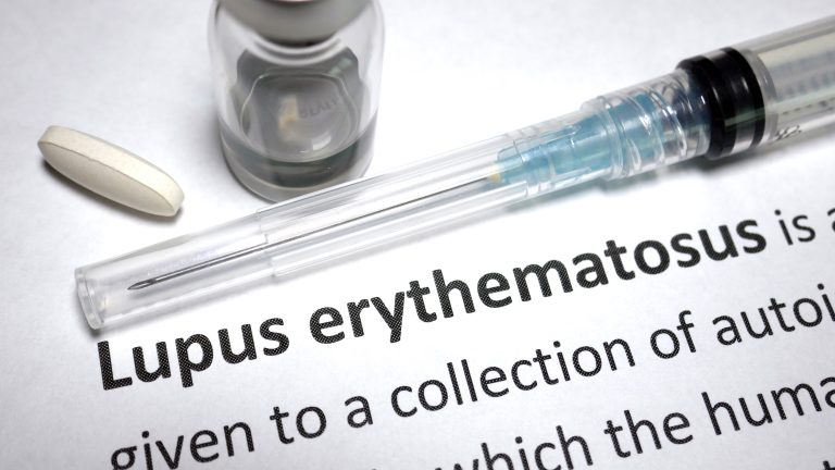 Vaccine Booster Reduces Likelihood of Lupus Patients Having Breakthrough COVID Infection
