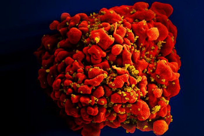 Accelerated Aging Process at the DNA Level Seen after HIV Infection