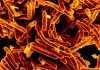 Antibiotic Resistant Genes Uncovered in Tuberculosis
