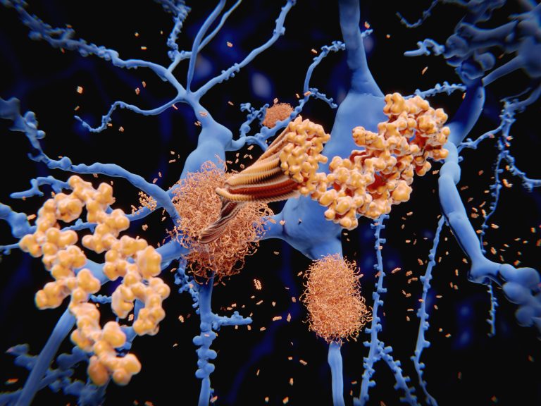 Alzheimer’s Disease Hallmarks Diminish on Removal of Neuronal Lipoprotein in Mice