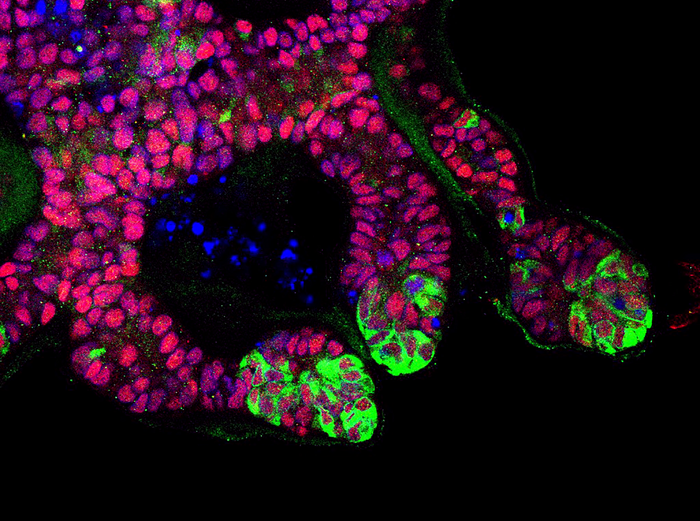 Organoids Move One Step Closer to Human Kidneys