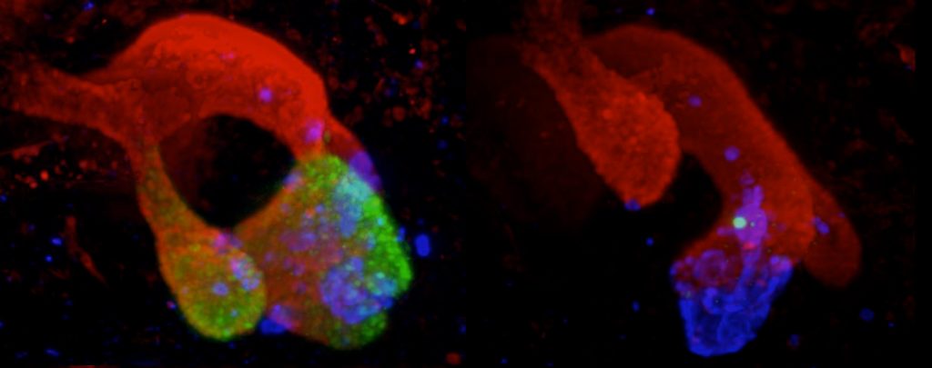 pancrease