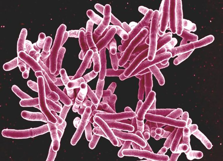 Biofilm-Like <em>Mycobacterium Tuberculosis</em> Cords Complicate Pathogenesis