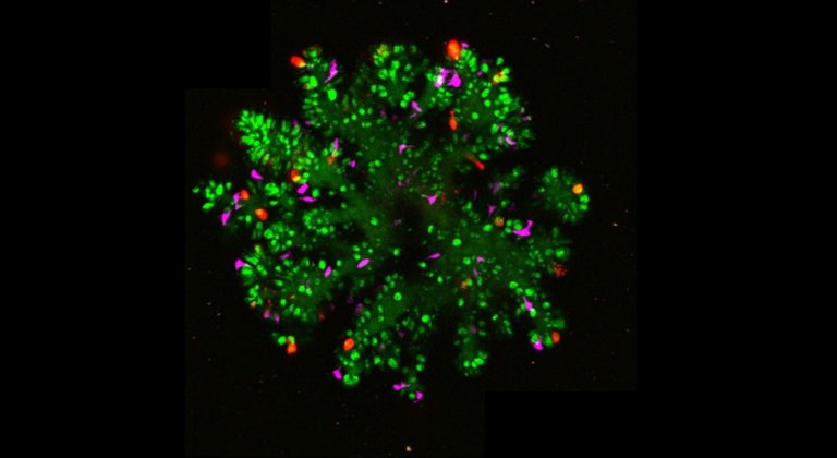 Organoid Culture Optimized to Match Human Small Intestines