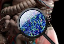 Microbiome Helps Identify Who Benefits from Combination Immunotherapy