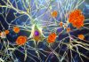 Alzheimer’s Disease Progression Slowed Down by Microglia Activation