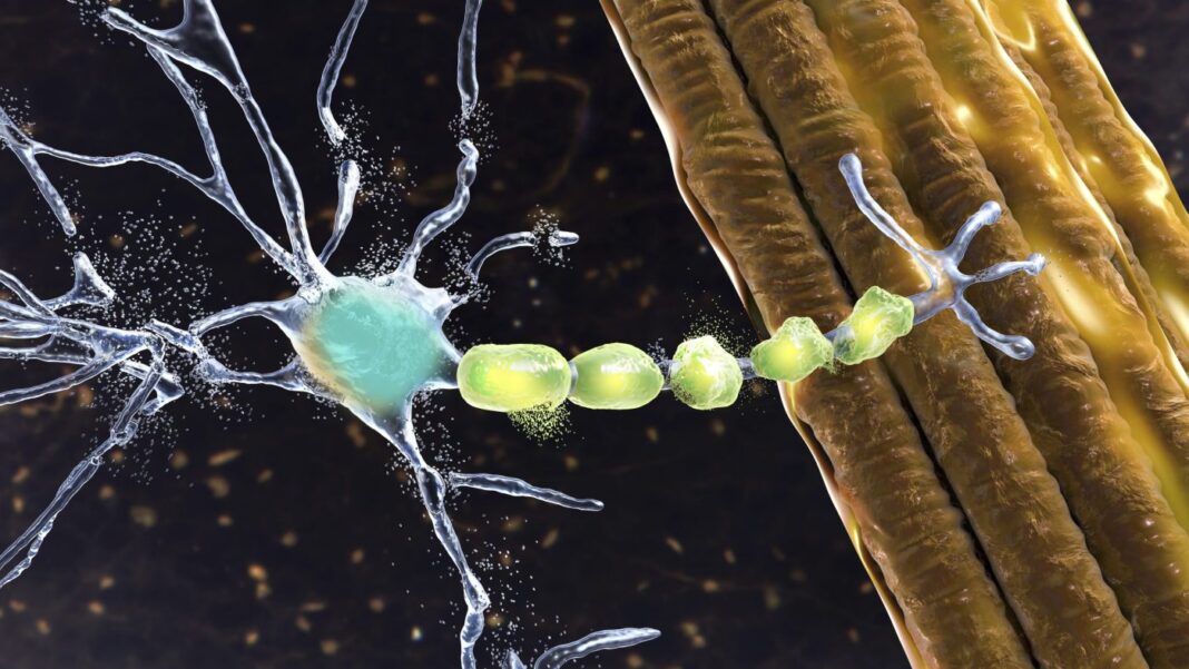 Degradation of motor neurons, illustration
