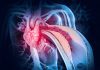 Experimental Cancer Drug Slows Inflammation in Animal Models of Heart Disease