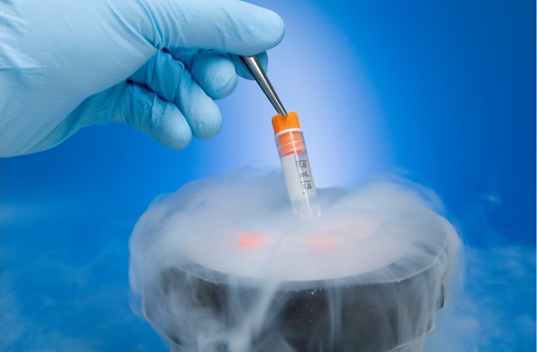 Cryopreservation of samples.
