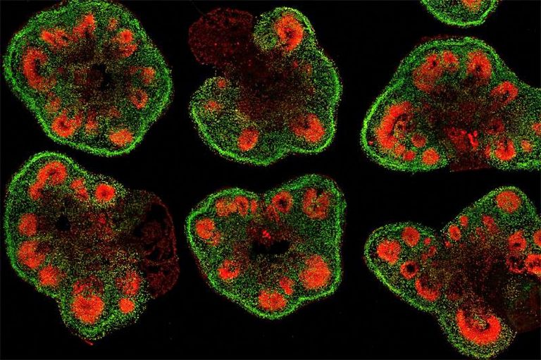 Neural Organoids Making Connections, Getting Real