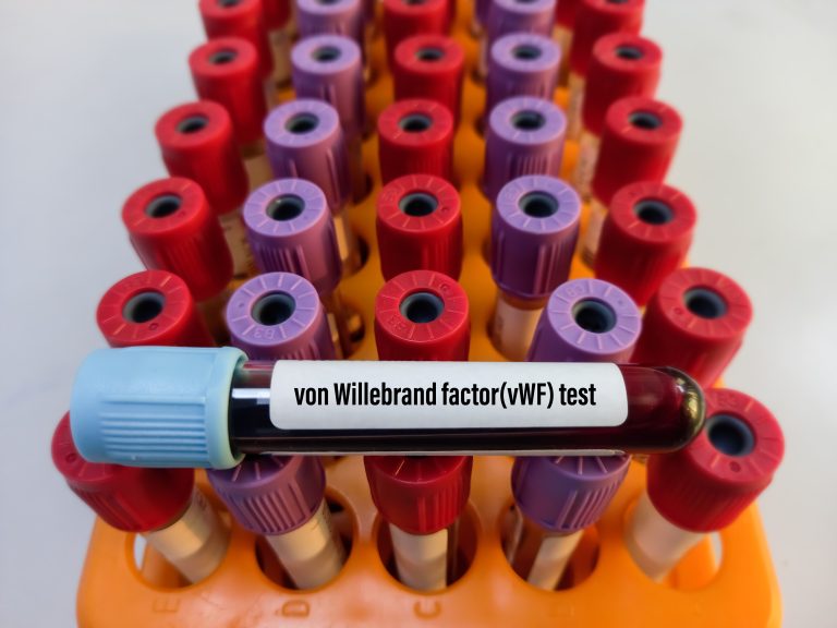 New Role Found for von Willebrand Factor, a Blood Clotting Protein