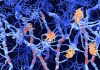 Blood Biomarker Reveals Signs of Multiple Sclerosis Years Before
