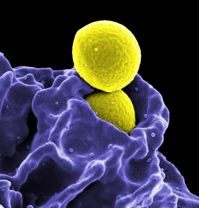 Anti-<em>S. aureus</em> mAbtyrin Biologic Targets Multiple Bacterial Virulence Strategies