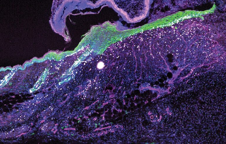 Ancient Mechanism Restores Wounded Tissue