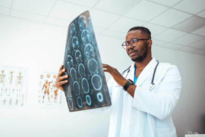 Getty-1426197869 Doctor looking at MRI scans of the brain.