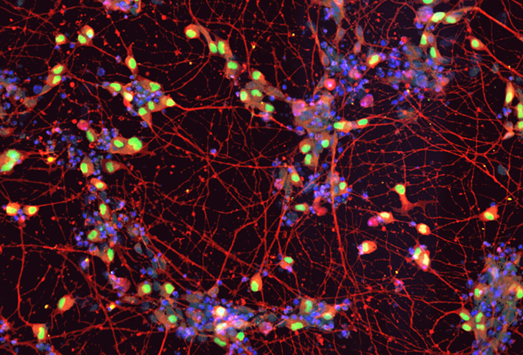 iPSCs-derived Motor neurons