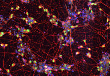 Parkinson’s Disease Drug Slows ALS Progression in Clinical Trial