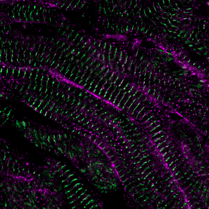 Heart Regeneration in Zebrafish Depends on Conserved Mechanism