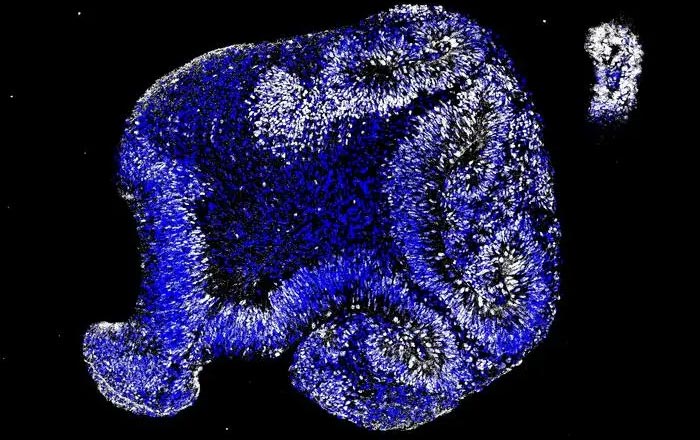 Stem Cell Model Points to Alzheimer’s Disease Embryonic Origins