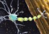 ALS-Linked Protein Could Be Target for Neurodegenerative Disease Therapies