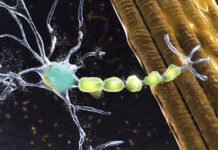 ALS-Linked Protein Could Be Target for Neurodegenerative Disease Therapies
