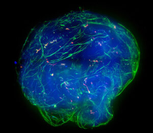 Brain Micro TIssues