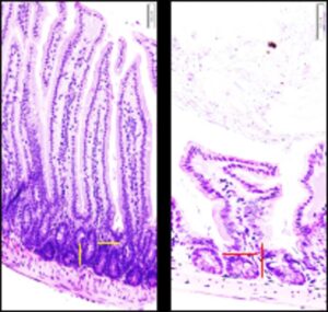 The inner folds of the intestines (purple) are different in healthy mice (left) compared to mice fed a high-fat diet (right). Salk researchers identified changes in bacteria and bile acids that drive these changes.