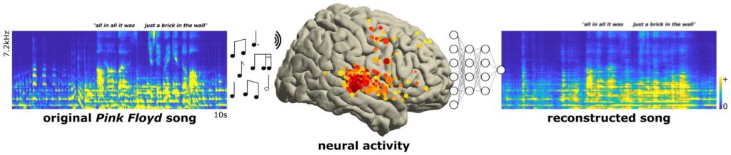 Neuroscientists recorded electrical activity from areas of the brain (yellow and red dots) as patients listened to a 3-minute snippet of the Pink Floyd song, “Another Brick in the Wall, Part 1.” Using artificial intelligence software, they were able to reconstruct the song from the brain recordings. This is the first time a song has been reconstructed from intracranial electroencephalography recordings.