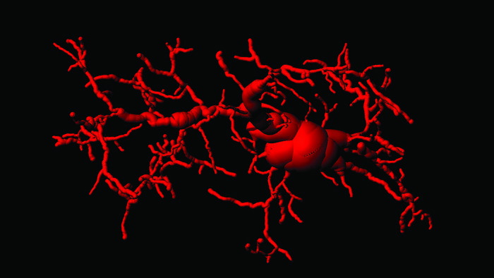 An activated microglial cell in the brain of cGAS/STING activated mice