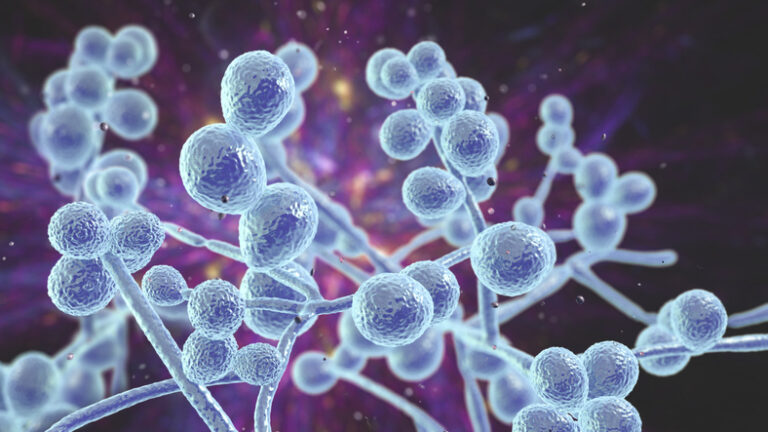 Candida Albicans Produces Alzheimer’s-Like Changes in the Brain
